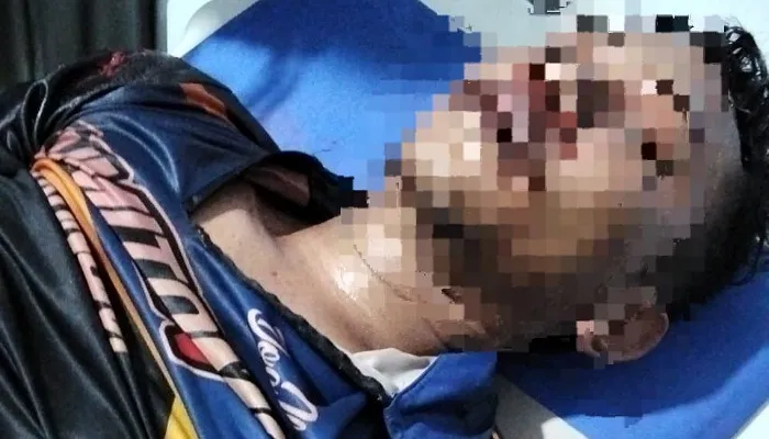 Polres Merangin Tetapkan RC dan RS Tersangka Pengeroyokan Usai Keributan di Kafe