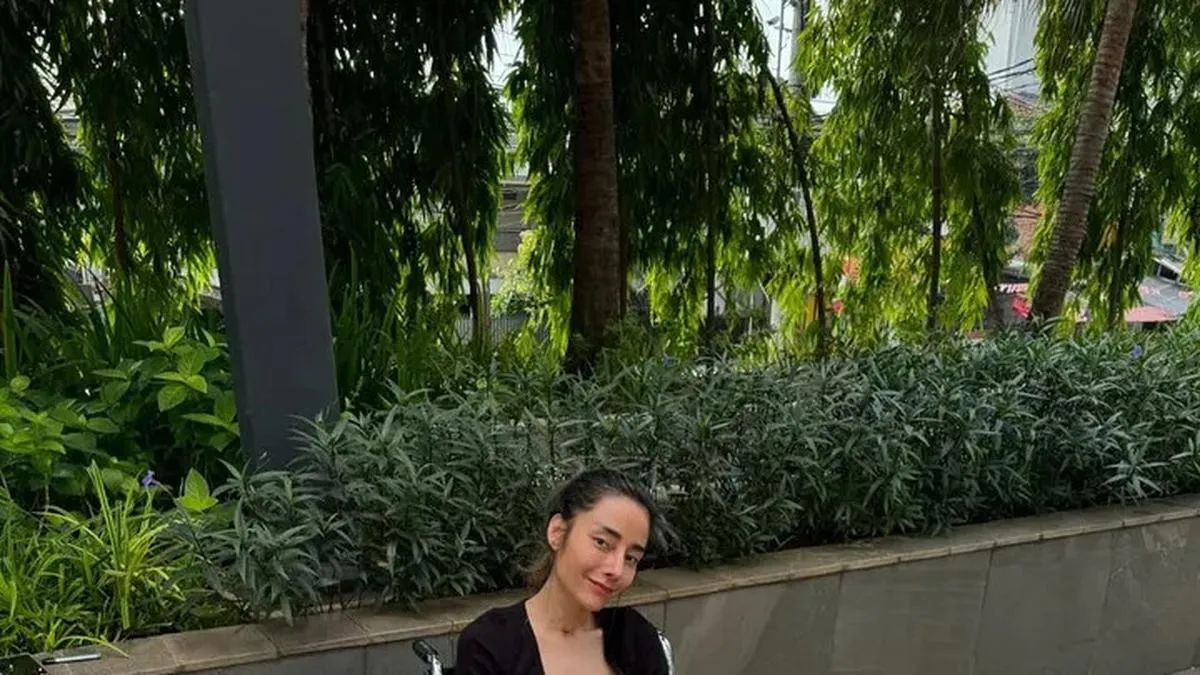 Meme Flome: Seleb TikTok Jatuh Cinta Operasi Plastik Berujung Malpraktik