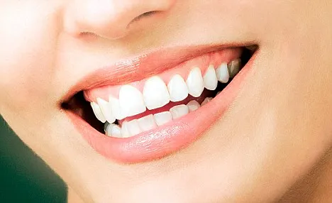 Pendekatan Terintegrasi untuk Atasi Gummy Smile Ekstrem