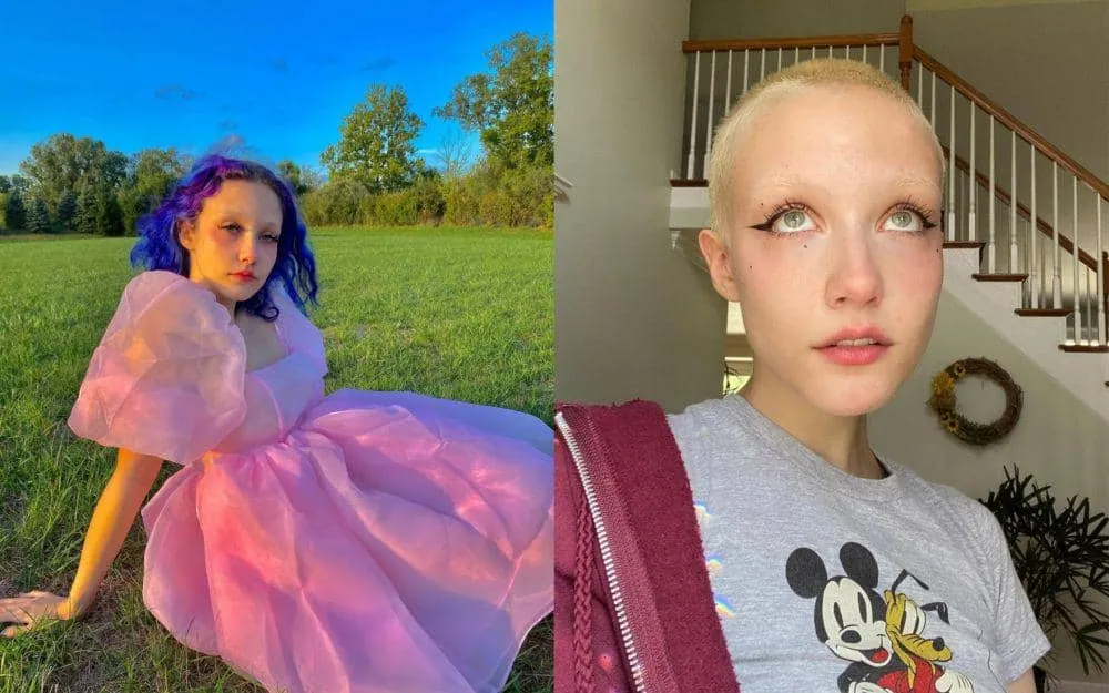 Fakta Menarik Seputar Chloe Moriondo yang Tampil Segar dengan Kepala Botak