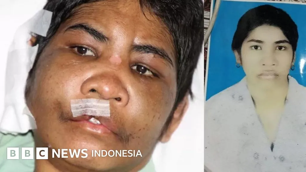 Sidang Kasus Penyiksaan PMI Asal NTT: Polisi Malaysia Sebut Meriance Kabu Alami Cedera Fatal
