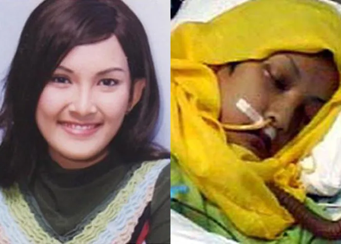 Artis Sukma Ayu Meninggal Dunia Setelah Koma Lima Bulan Akibat Penyakit Jantung
