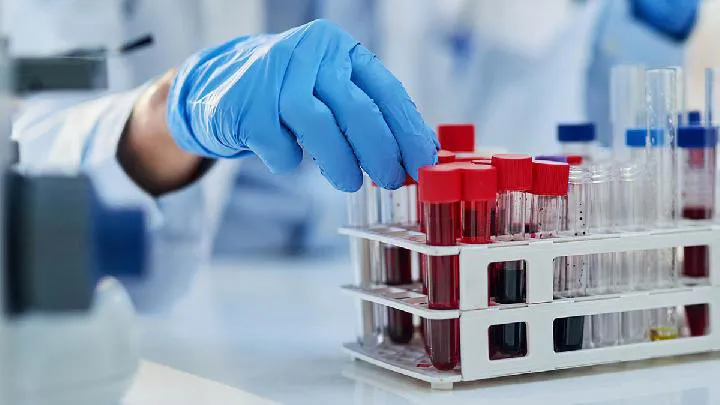 Proyek UK Biobank: Mendeteksi Penyakit Melalui Pemetaan Metabolit Darah