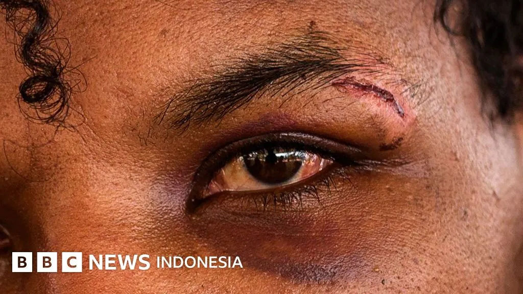 Bebas dari Pusat Penipuan di Myanmar, Ribuan Orang Terlantar di Kamp Penampungan Darurat