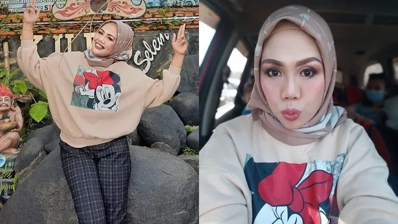 Elly Sugigi Tampil Memukau Setelah Perawatan Kecantikan