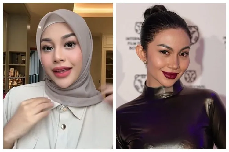 Transformasi Selebriti Indonesia Setelah Filler Bibir, Femmy Permatasari Investasi Rp300 Juta