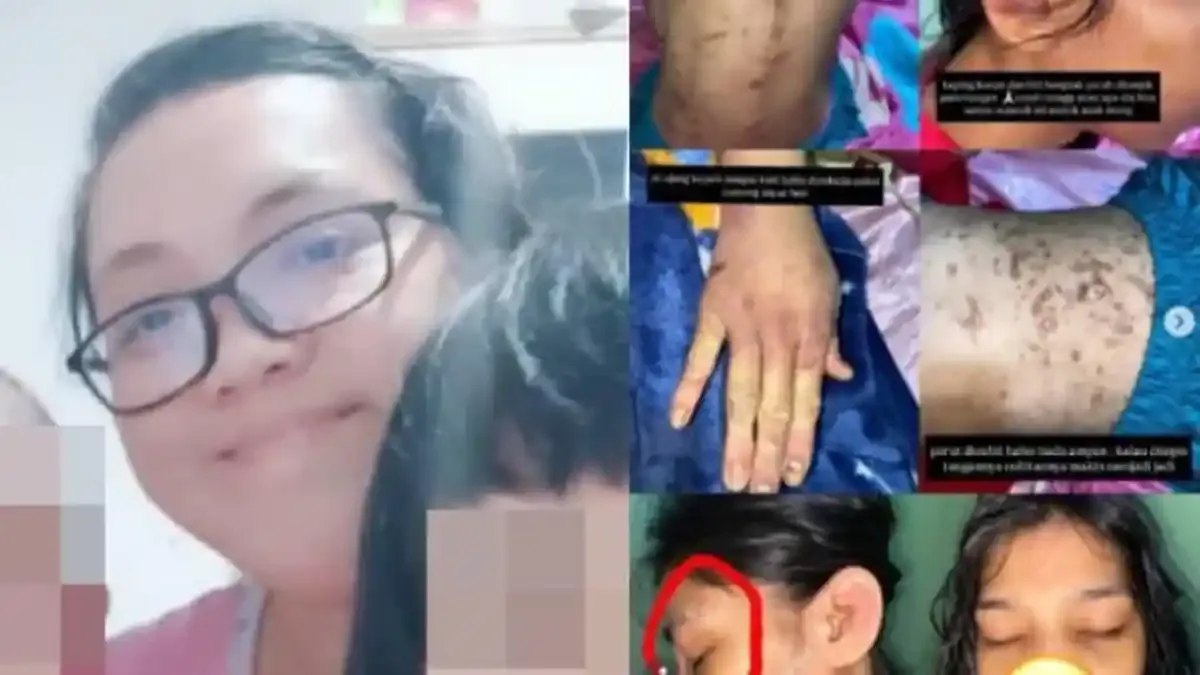 ASN BPK di Bogor Diduga Aniaya ART dan Suami