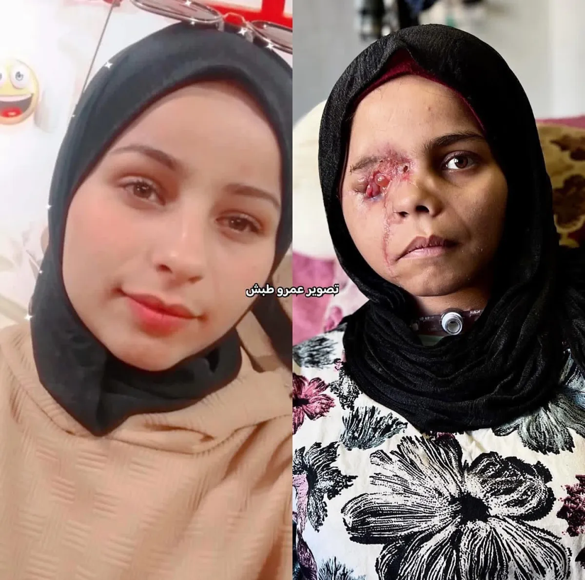 Nada Arhouma: Harapan yang Tersimpan di Tengah Reruntuhan Gaza