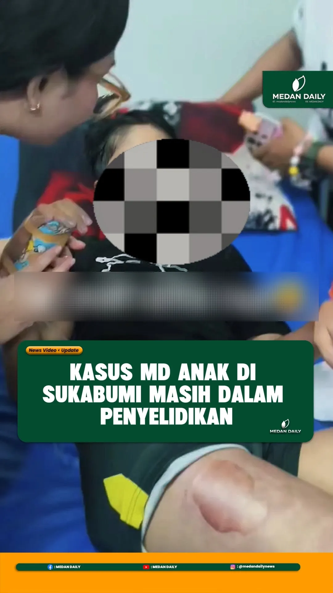 Bocah 12 Tahun Diduga Korban Kekerasan di Sukabumi Meninggal Dunia