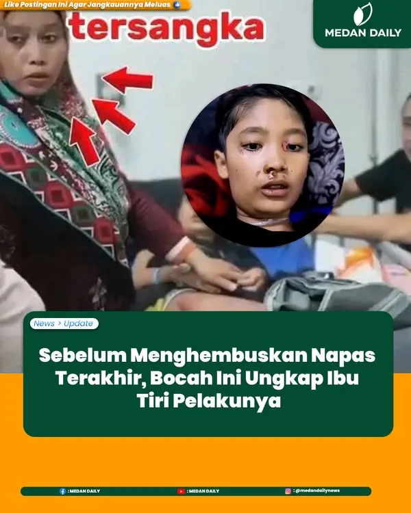 Bocah 12 Tahun Viral karena Luka Parah di Tubuhnya