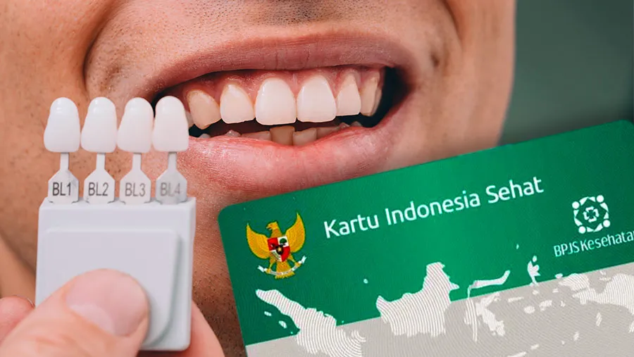 Pemasangan Gigi Palsu Melalui BPJS Kesehatan: Syarat dan Ketentuan 2026