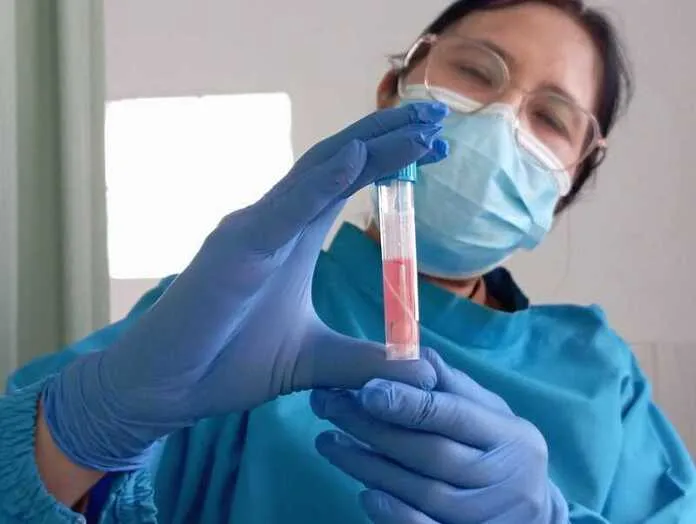 Pemerintah Kota Bandung Tingkatkan Kewaspadaan Terhadap Super Flu Subclade K