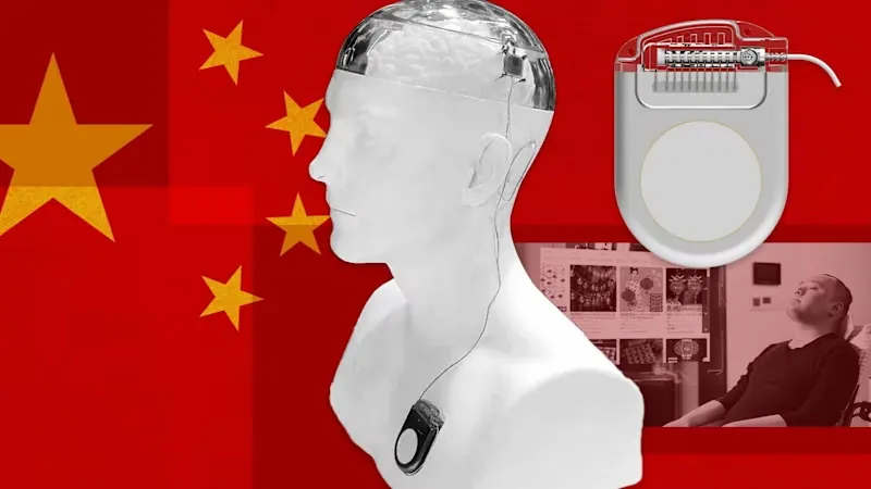 Tiongkok Percepat Inovasi Implan Otak untuk Saingi Neuralink