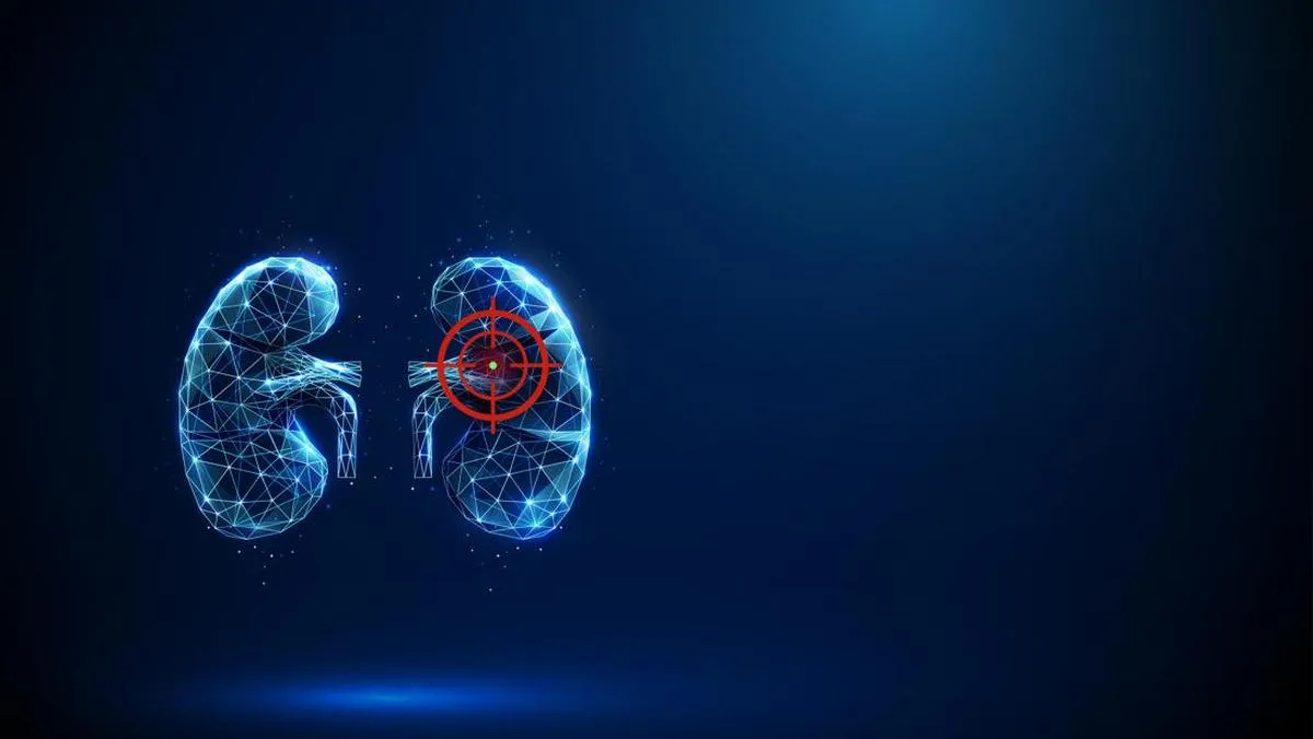Diabetes sebagai Penyebab Utama Gagal Ginjal di Indonesia