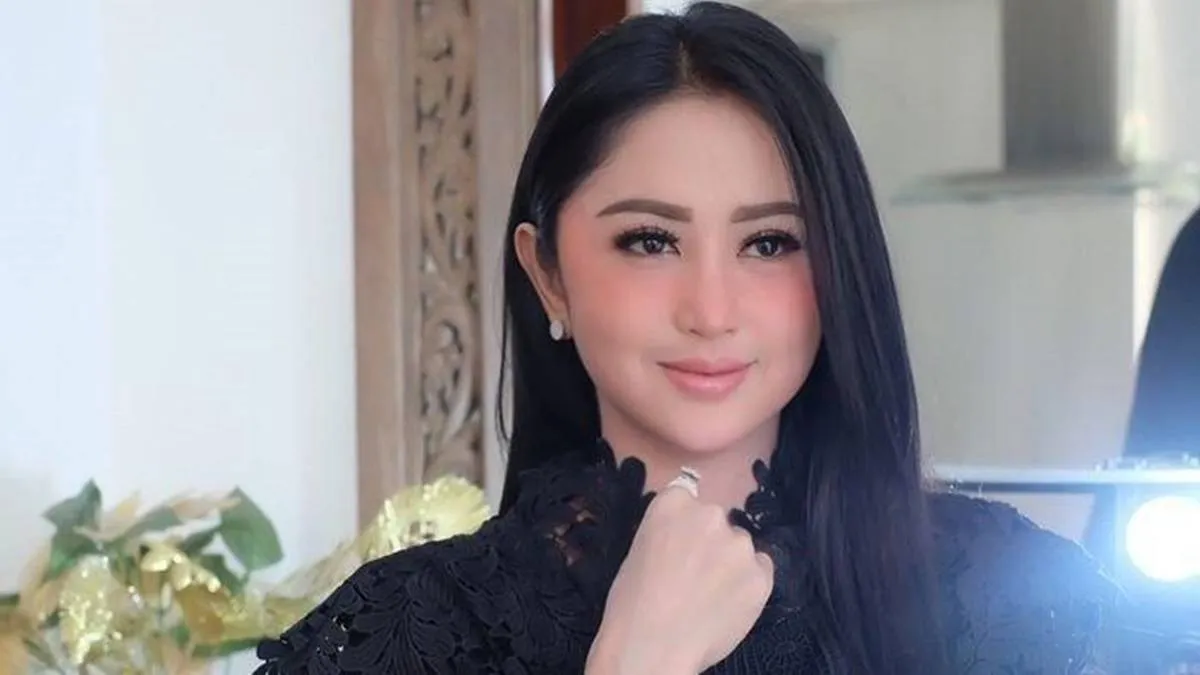 Dewi Perssik Berbagi Pengalaman Sembuh dari Covid-19 dengan Ruam Kulit