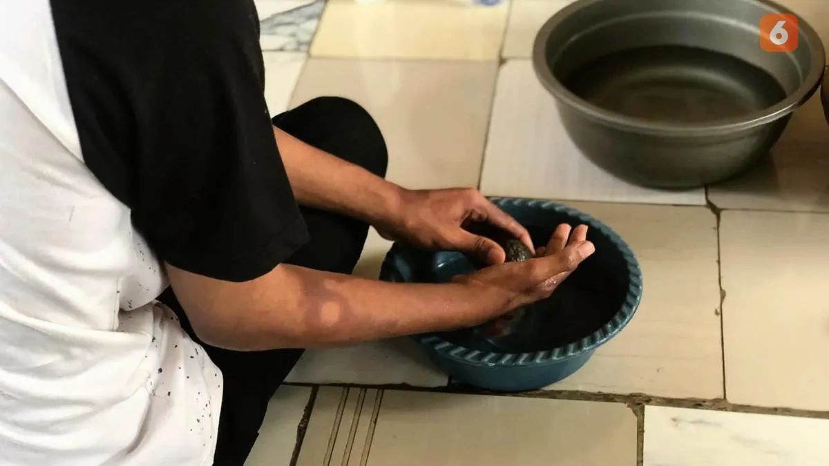 Bedah Plastik Rekonstruksi: Solusi untuk Disabilitas Akibat Kusta?
