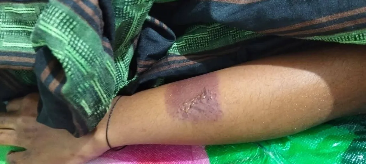 Keluarga Veronika Cabut Laporan, Penyelidikan Kasus Penganiayaan Tetap Berlanjut