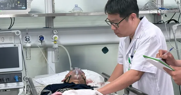 Kecelakaan Kembang Api Warnai Liburan Imlek, 28 Kasus Terjadi