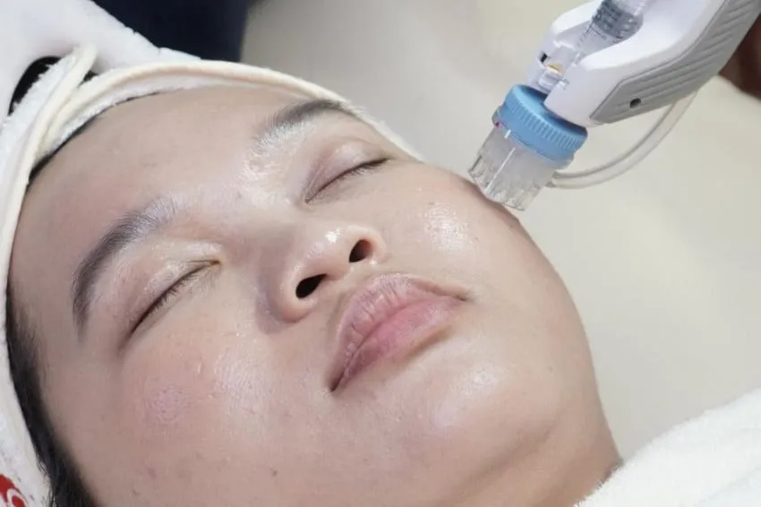 Remee Pro: Inovasi Teknologi Injector untuk Skinbooster Lebih Optimal