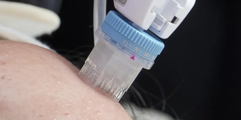 Immoderma Clinic Luncurkan Remee Pro, Inovasi Injector Skinbooster Terbaru