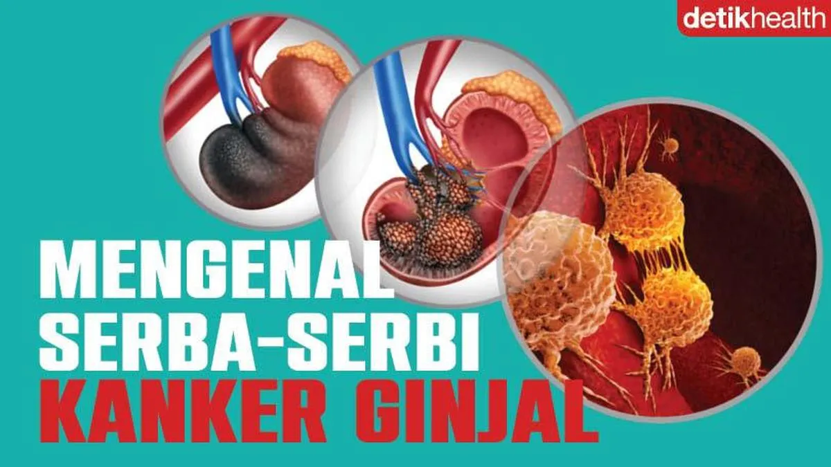 Pola Makan Tertentu Tingkatkan Risiko Kanker Ginjal