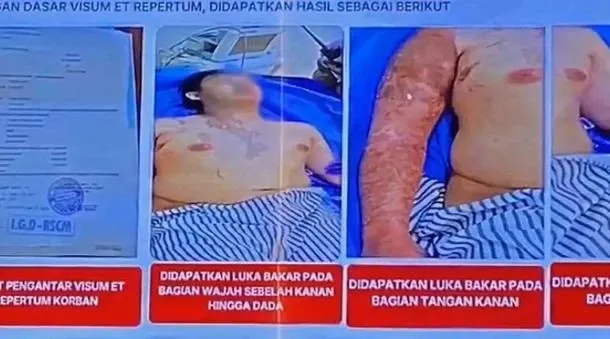 Koalisi Masyarakat Sipil Desak Peradilan Umum untuk Kasus Penyiraman Air Keras Aktivis HAM