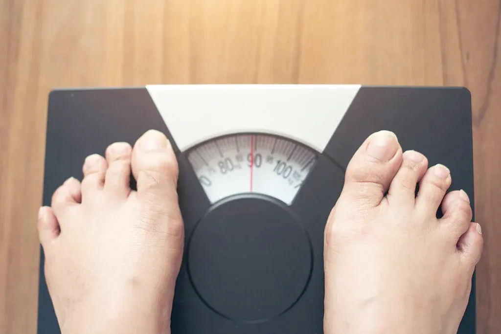 Obesitas di Usia Produktif: Ancaman Gaya Hidup Modern dan Cara Mengatasinya