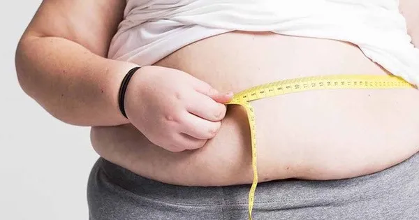 Tantangan Obesitas di Vietnam: Perlu Lebih dari Diet dan Olahraga