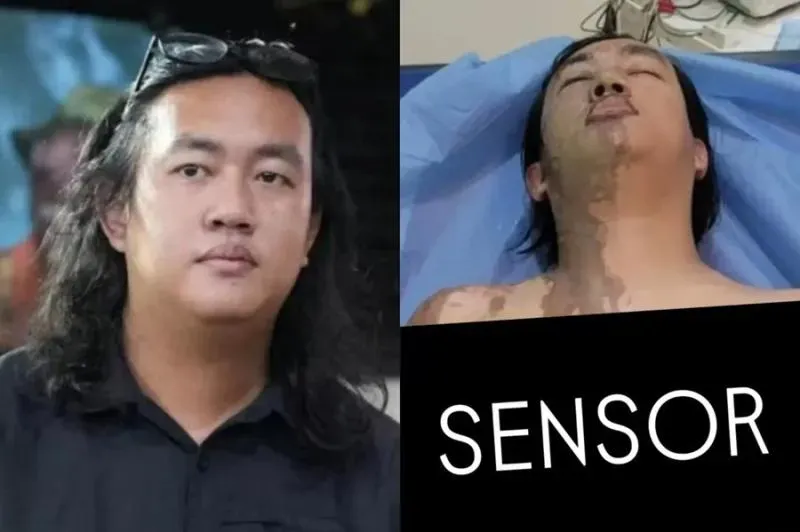 YLBHI Tolak Pengalihan Kasus Penyerangan Andrie ke Peradilan Militer