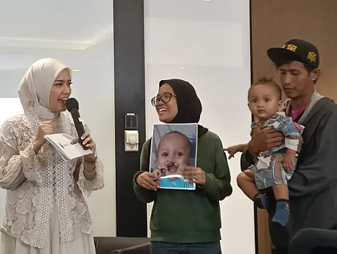 Smile Train Indonesia Gelar Operasi Bibir Sumbing Gratis dan Perawatan Komprehensif