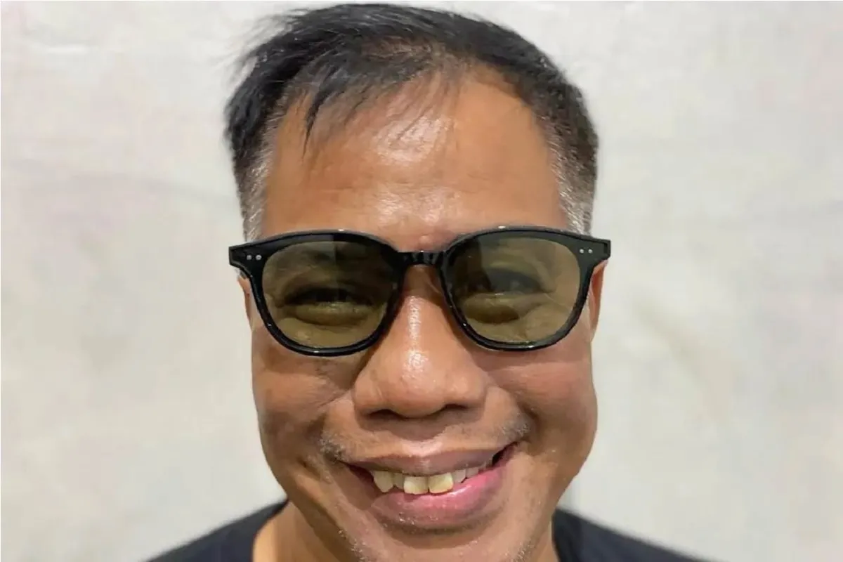Komedian Temon Templar Meninggal Dunia
