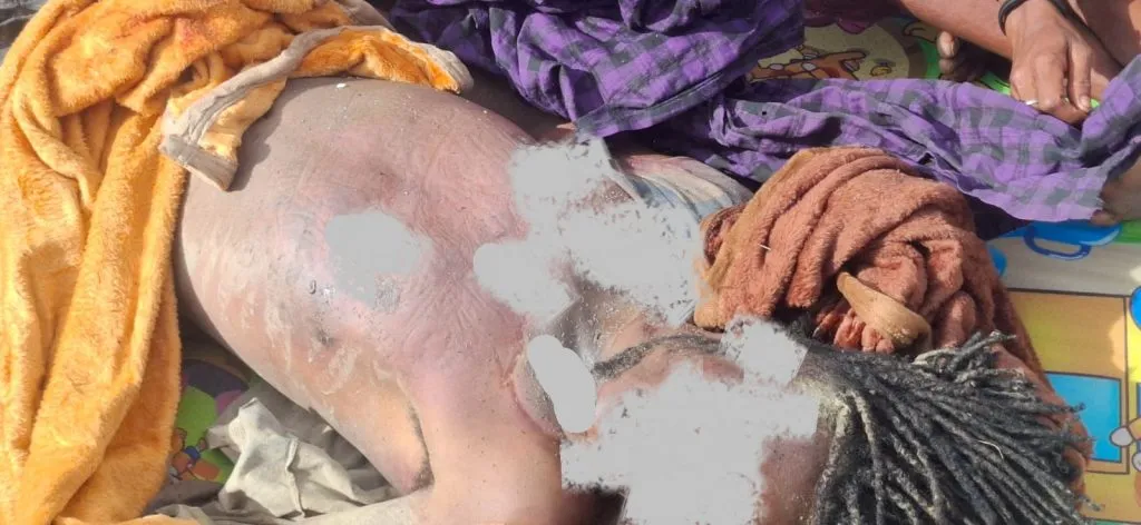 Koalisi HAM Lapor 14 Warga Sipil Jadi Korban Konflik di Intan Jaya