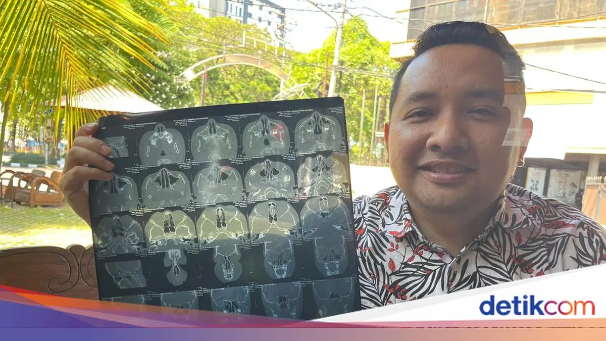 Mertua Respon Kasus Dokter Gigi di Surabaya yang Laporkan Suami ke Polisi